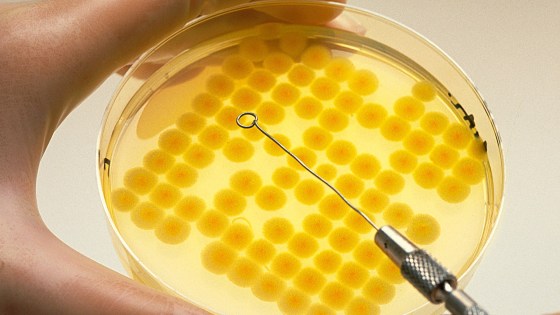 levá ruka drží petriho misku se žlutým obsahem, puntíky, v pravé ruce kovová inokulační klička dotýkající se vzorku